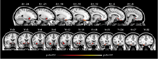 Prefrontal Connection